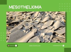 mesothelioma