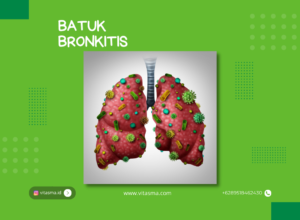 Batuk Bronkitis