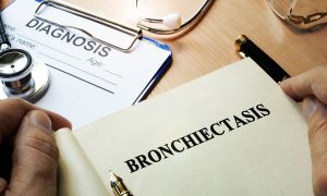 bronkiektasis