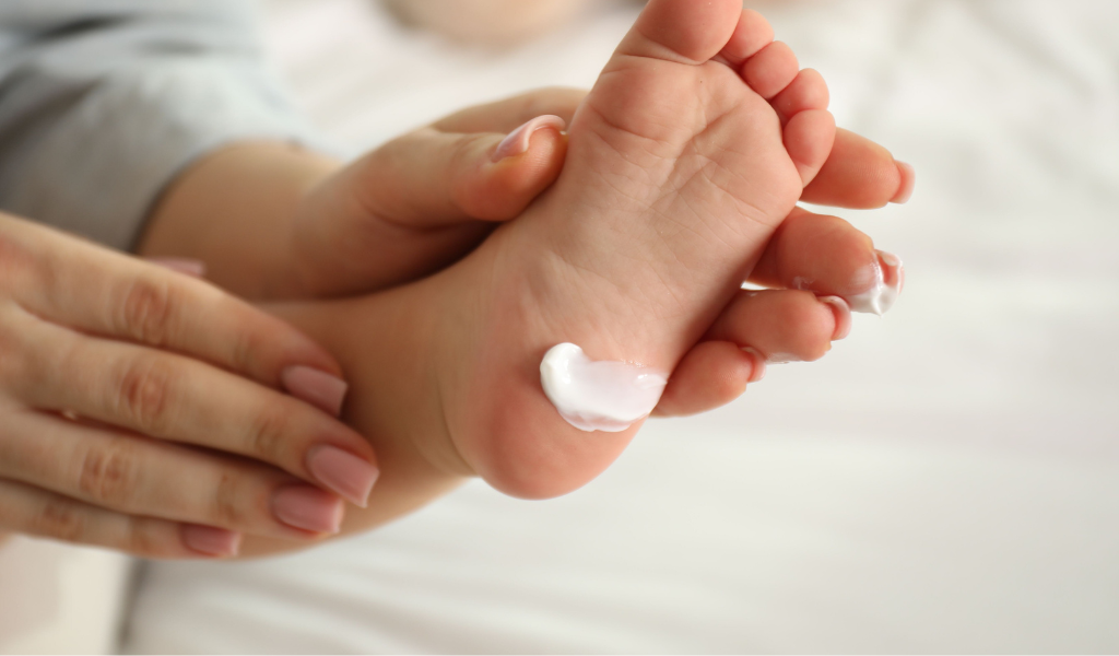 kulit bayi sensitif